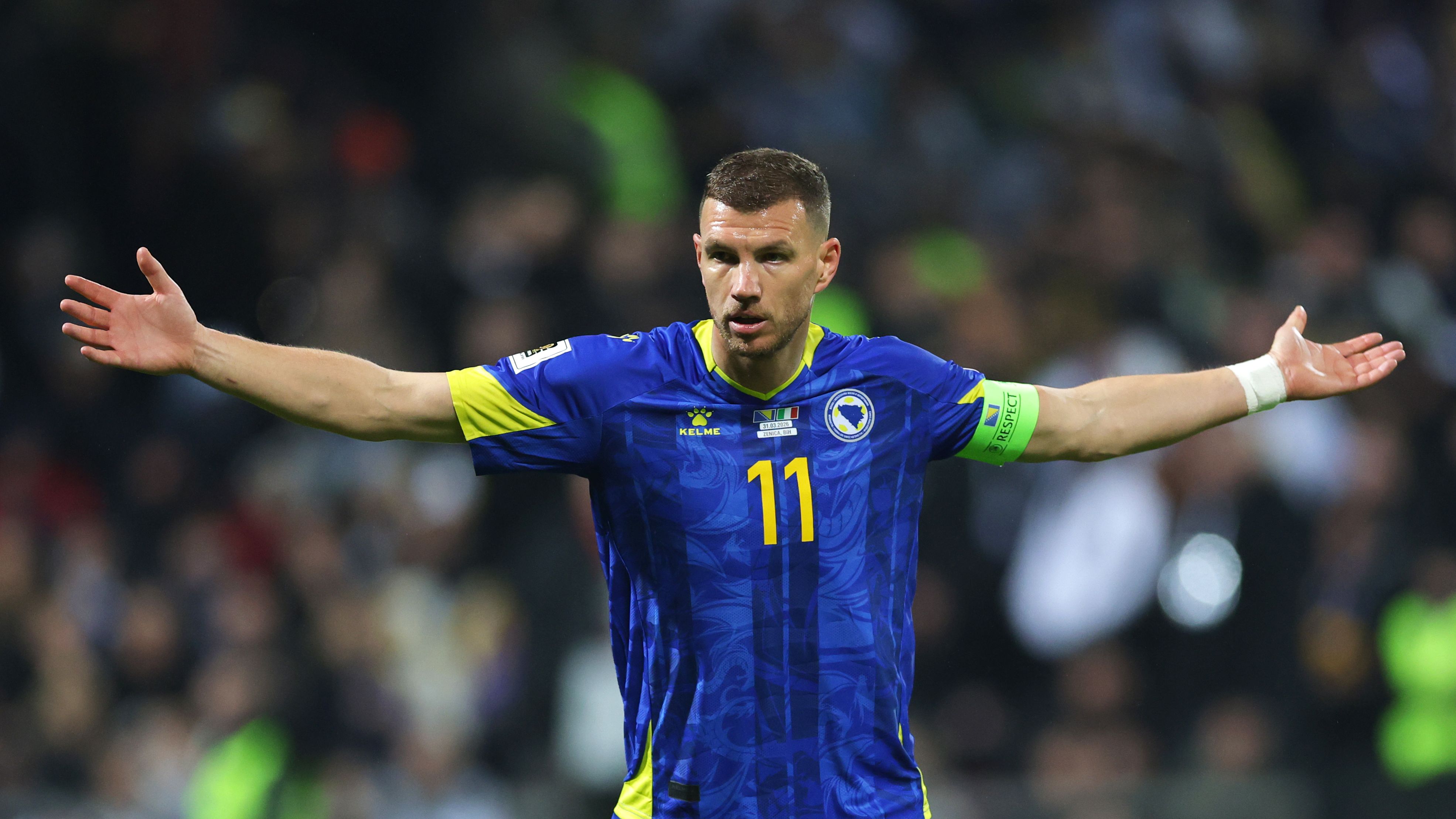 Dzeko: "La mattina ho dolori ovunque, non avrei mai pensato 