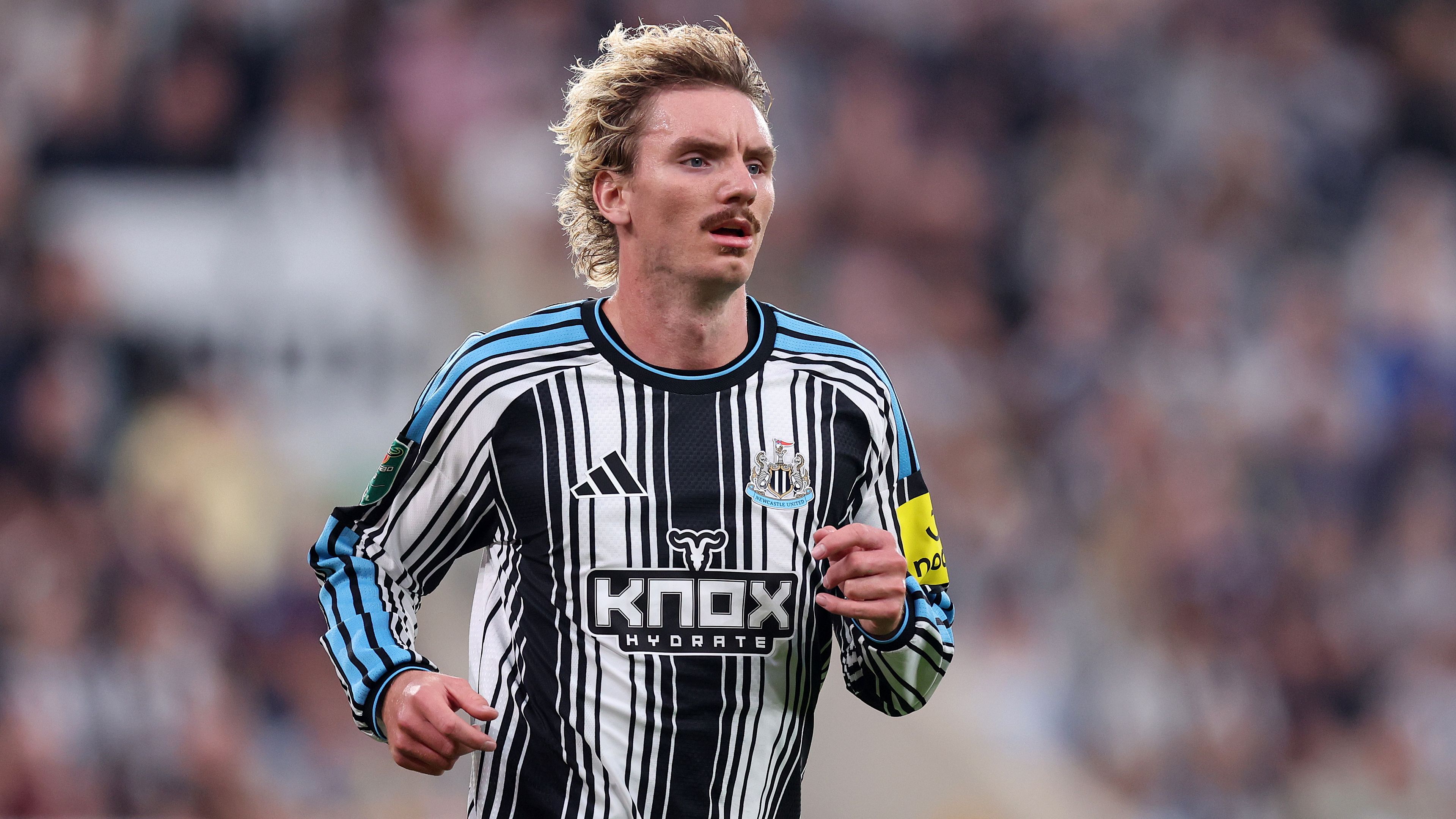 sondaggio-napoli-per-nick-woltemade-il-punto-sull-attacco-di-allegri